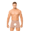 boxer-post-operatorio-ann-chery-5172